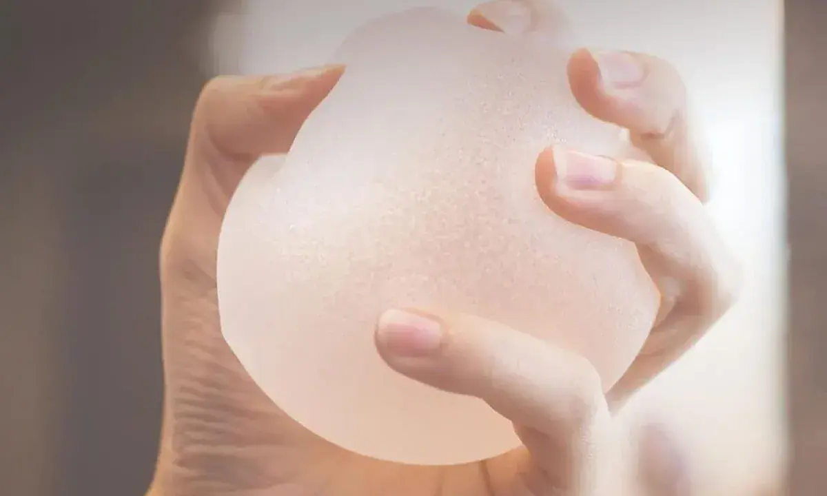 Mano che stringe una protesi b lite, un impianto leggero e traslucido per un aspetto naturale.