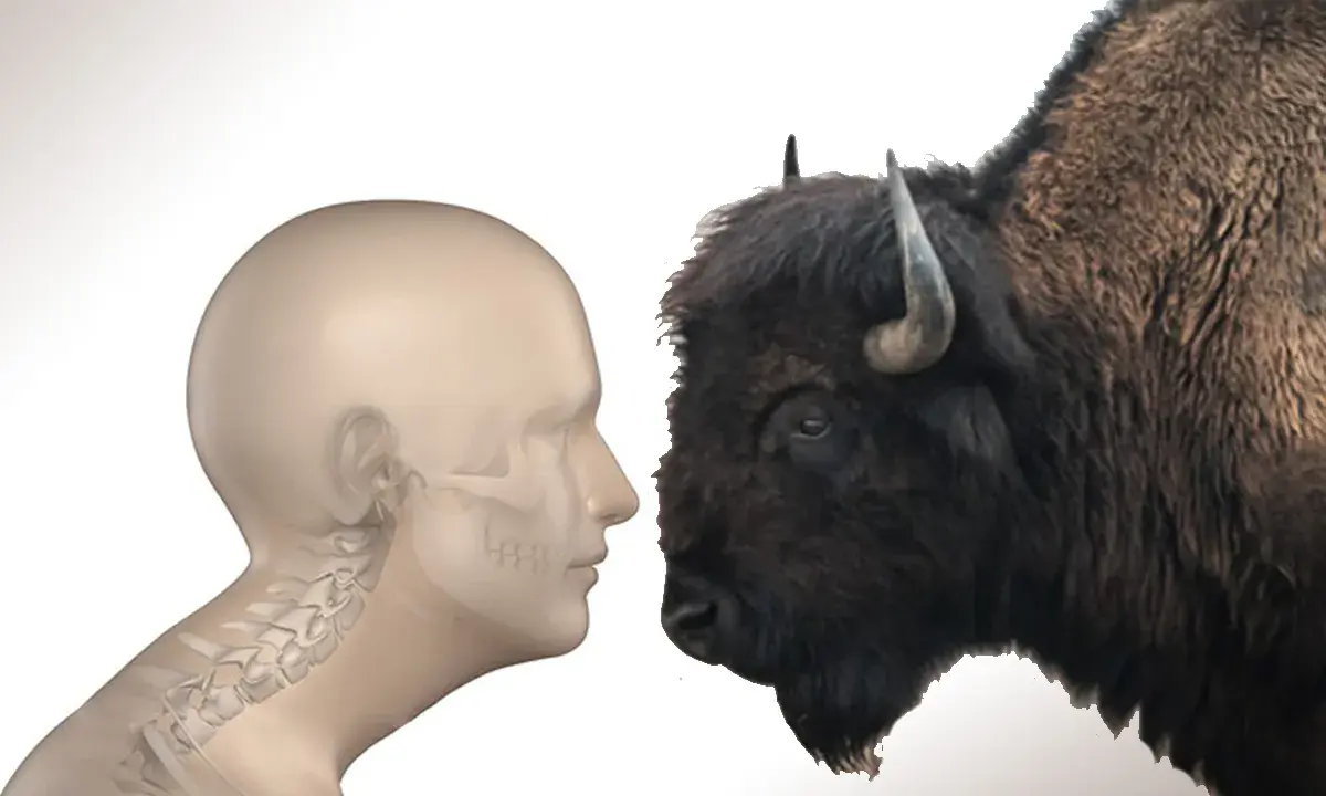 Profilo umano con scheletro cervicale e bisonte. Come eliminare la gobba del bisonte?
