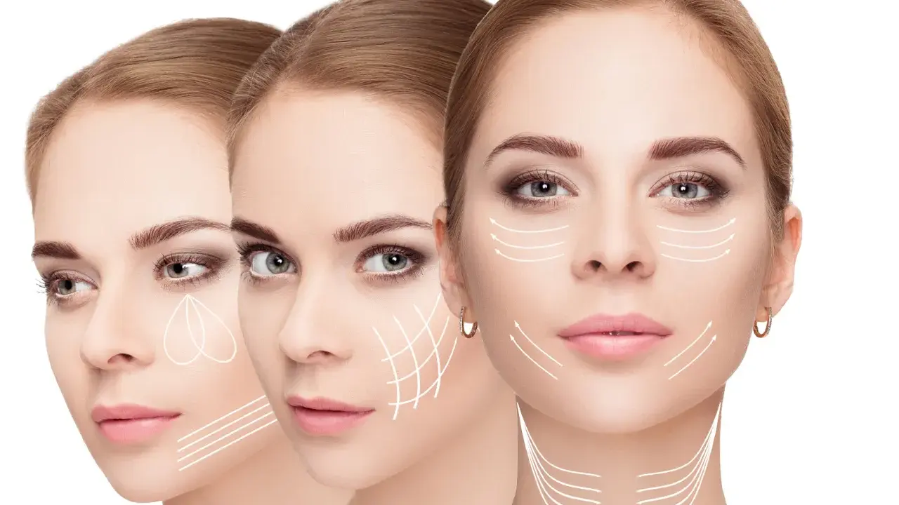 Tre volti femminili con frecce bianche che indicano le linee di tensione del prx viso, suggerendo trattamenti estetici.