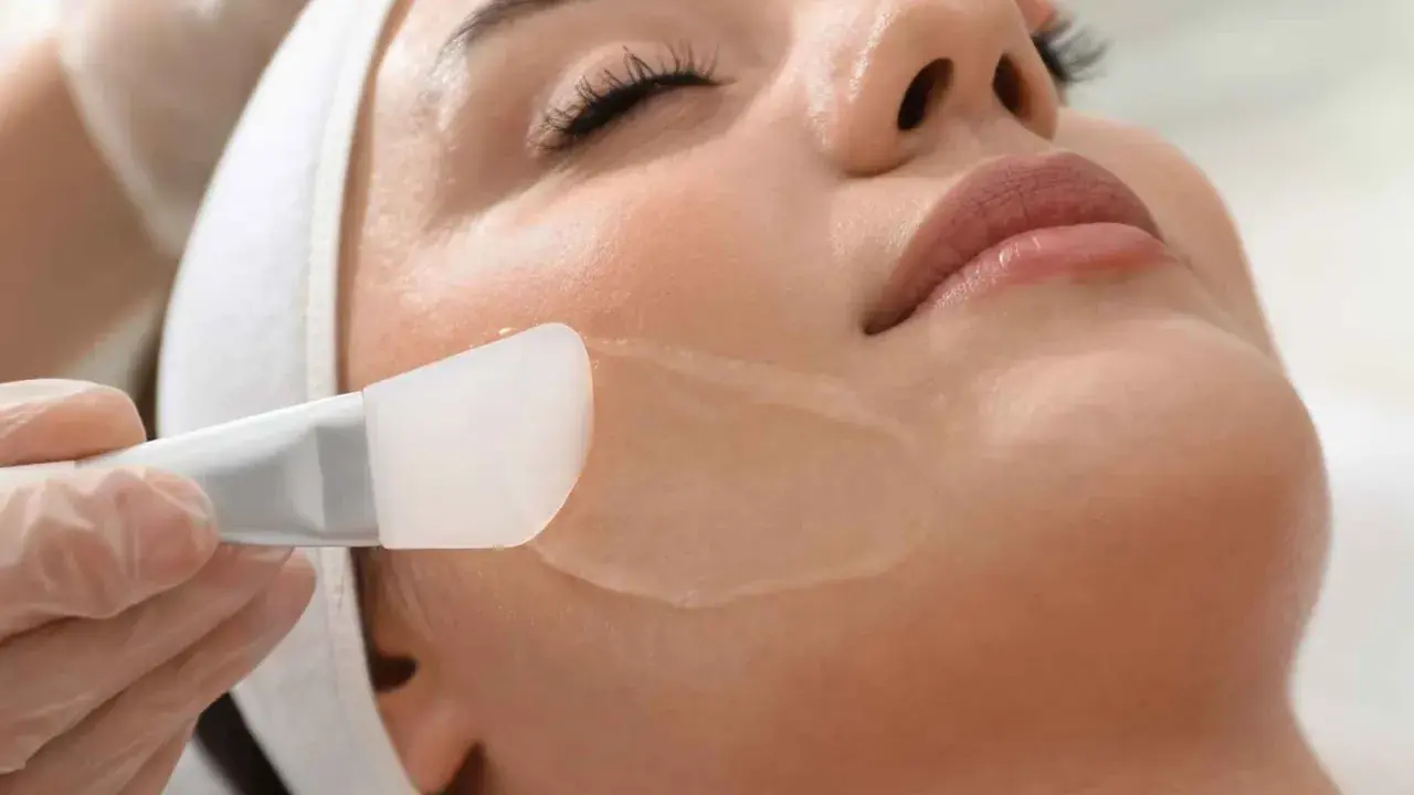 Applicazione di un peeling per acne sul viso di una donna, con un pennello in silicone.