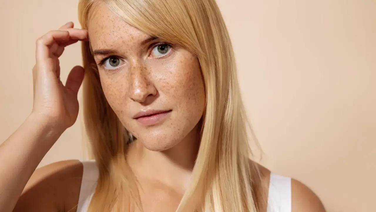 Giovane donna con lentiggini, capelli biondi e sguardo intenso. Immagina un trattamento di pico laser viso per una pelle radiosa.