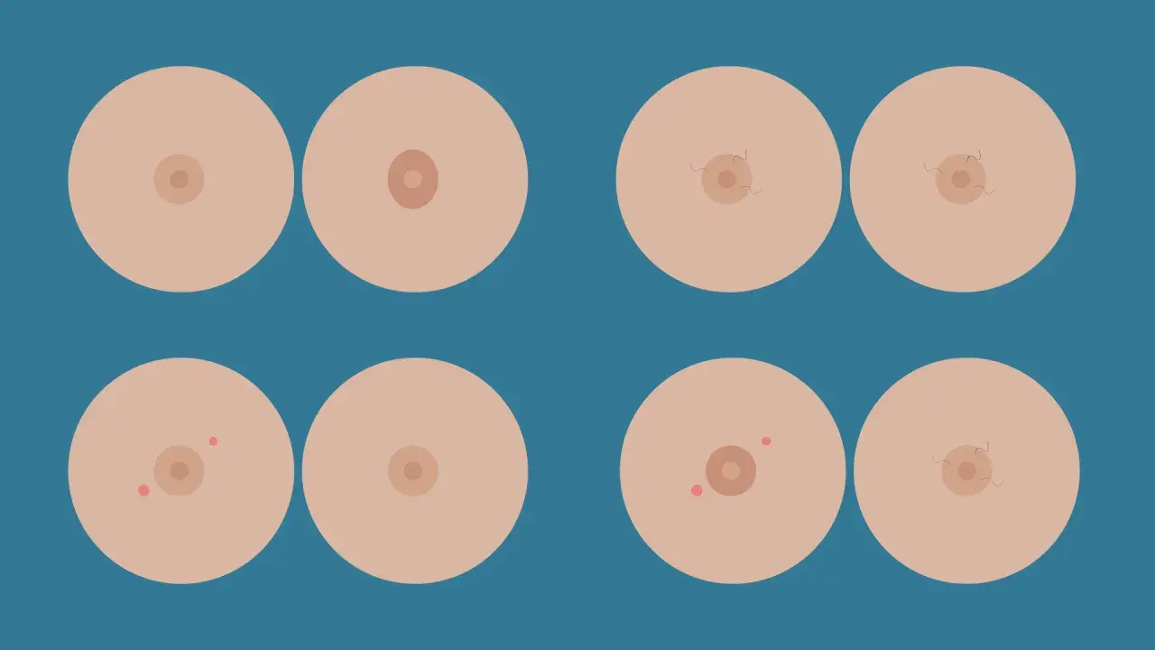 Illustrazione di seni con diverse forme di capezzoli, inclusi quelli piatti, a dimostrazione che un capezzolo piatto è normale.