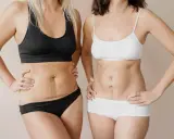 Due donne mostrano i loro addomi, uno con smagliature e l'altro con una cicatrice, un confronto prima e dopo un mommy makeover.
