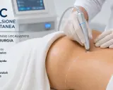 Trattamento LESC per la rimozione del grasso addominale senza intervento chirurgico. Lipoemulsione sottocutanea mini-invasiva per risultati visibili e naturali.