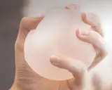 Mano che stringe una protesi b lite, un impianto leggero e traslucido per un aspetto naturale.