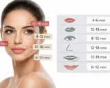 Volto femminile con indicazioni sulla durata degli effetti dell'acido ialuronico in diverse aree, utile per valutare le controindicazioni.
