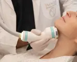 Medico esegue trattamento onda coolwaves sul collo di una donna per migliorare l'aspetto della pelle.