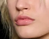 Labbra piene e luminose, effetto filler labbra naturale.