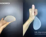 Protesi ergonomiche prima e dopo: un confronto visivo. La mano sinistra mostra una protesi rotonda, la destra una protesi a goccia.