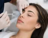 Una mano guantata inietta acido ialuronico Profhilo sul naso di una donna, per un ritocco estetico.