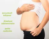 Addominoplastica cos'è: immagine mostra addome con accumuli adiposi, diastasi addominale e pelle cadente, condizioni trattabili.