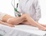 Trattamento estetico con tecnologia onda coolwaves per rimodellare il corpo.
