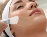 Applicazione di un peeling per acne sul viso di una donna, con un pennello in silicone.