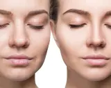 Viso prima e dopo: pelle imperfetta e spenta a sinistra, pelle luminosa e levigata a destra.