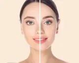 Volto diviso a metà: a sinistra sopracciglia naturali, a destra definite. Il solco naso giugale è visibile, evidenziando la differenza.