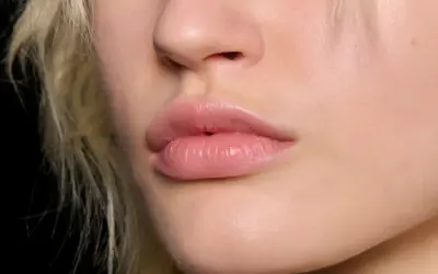 Labbra piene e luminose, effetto filler labbra naturale.