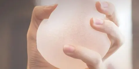 Mano che stringe una protesi b lite, un impianto leggero e traslucido per un aspetto naturale.