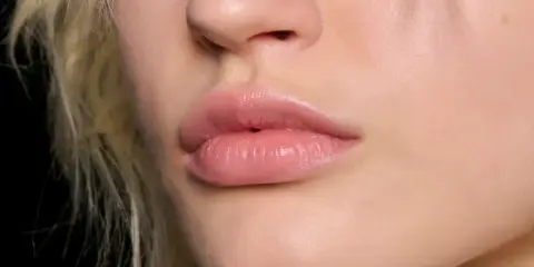 Labbra piene e luminose, effetto filler labbra naturale.