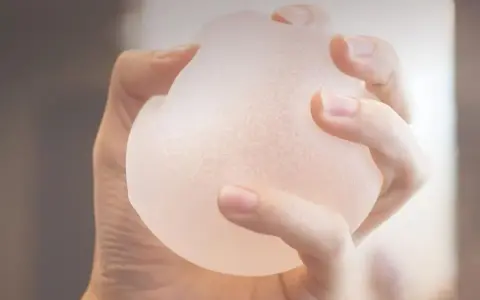Mano che stringe una protesi b lite, un impianto leggero e traslucido per un aspetto naturale.