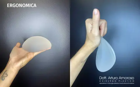 Protesi ergonomiche prima e dopo: un confronto visivo. La mano sinistra mostra una protesi rotonda, la destra una protesi a goccia.