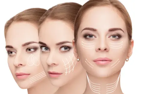 Tre volti femminili con frecce bianche che indicano le linee di tensione del prx viso, suggerendo trattamenti estetici.