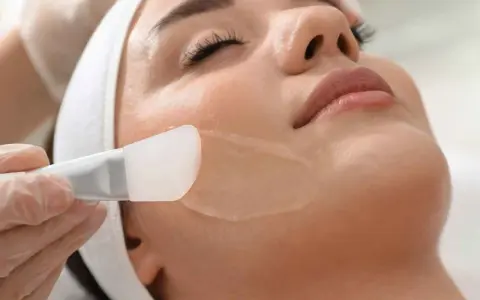 Applicazione di un peeling per acne sul viso di una donna, con un pennello in silicone.