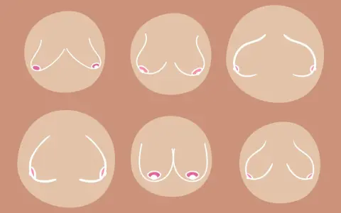 Illustrazione di sei seni cadenti, con diverse forme e posizioni, rappresentati con linee bianche su sfondo color carne.