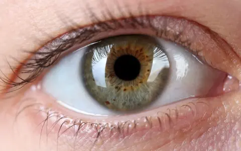 Occhio con iride verde-marrone, ciglia scure e pelle chiara. Un'immagine che evoca la ricerca di un filler per palpebre cadenti per uno sguardo più giovane.