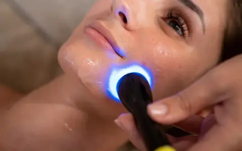 Primo piano di un viso sottoposto a biorivitalizzazione con luce blu. Informarsi sulle biorivitalizzazione viso controindicazioni prima del trattamento.