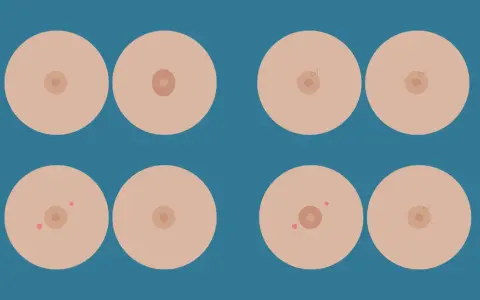 Illustrazione di seni con diverse forme di capezzoli, inclusi quelli piatti, a dimostrazione che un capezzolo piatto è normale.
