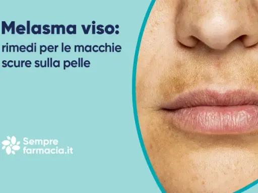 Primo piano del viso con melasma, evidenziando la zona baffetti scura e macchie sulla pelle. Rimedi per il melasma.