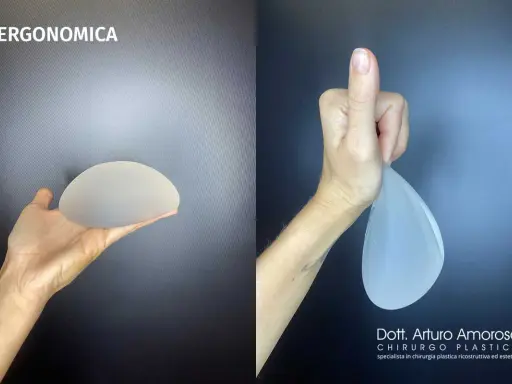 Protesi ergonomiche prima e dopo: un confronto visivo. La mano sinistra mostra una protesi rotonda, la destra una protesi a goccia.