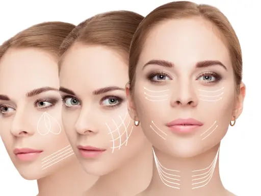 Tre volti femminili con frecce bianche che indicano le linee di tensione del prx viso, suggerendo trattamenti estetici.