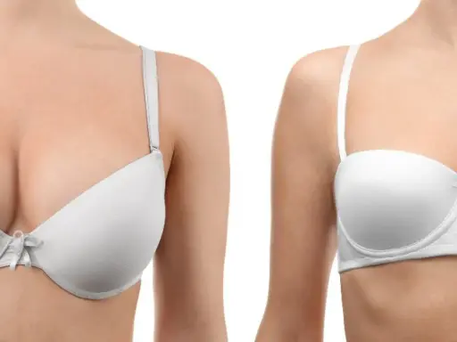 Primo piano di un seno rifatto taglia 4 a goccia, con un reggiseno bianco.