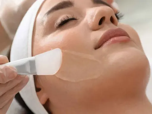 Applicazione di un peeling per acne sul viso di una donna, con un pennello in silicone.