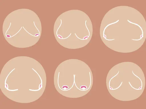 Illustrazione di sei seni cadenti, con diverse forme e posizioni, rappresentati con linee bianche su sfondo color carne.