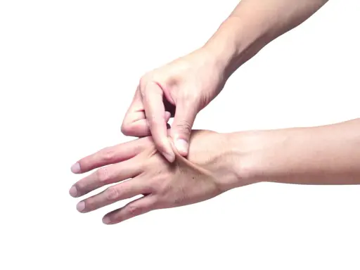 Mano che pizzica la pelle per testarne l'elasticità.