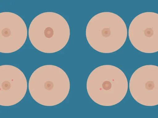 Illustrazione di seni con diverse forme di capezzoli, inclusi quelli piatti, a dimostrazione che un capezzolo piatto è normale.