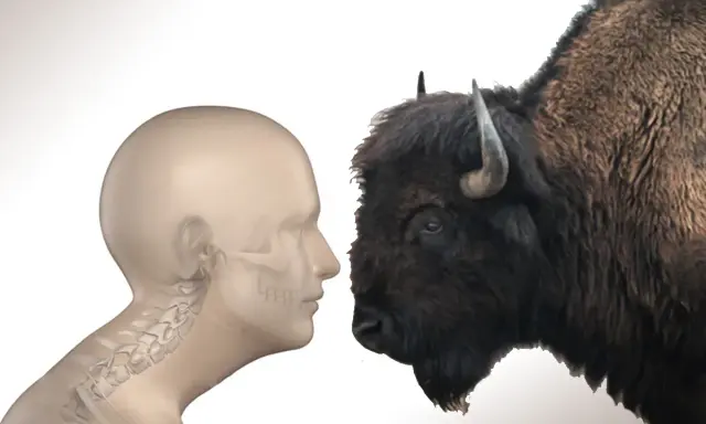 Profilo umano con scheletro cervicale e bisonte. Come eliminare la gobba del bisonte?