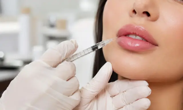Mani guantate iniettano filler labbra per un aspetto più pieno e sensuale.