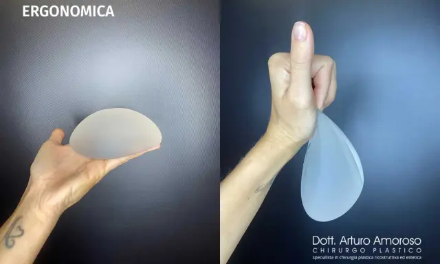 Protesi ergonomiche prima e dopo: un confronto visivo. La mano sinistra mostra una protesi rotonda, la destra una protesi a goccia.