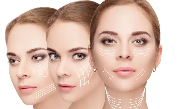 Tre volti femminili con frecce bianche che indicano le linee di tensione del prx viso, suggerendo trattamenti estetici.