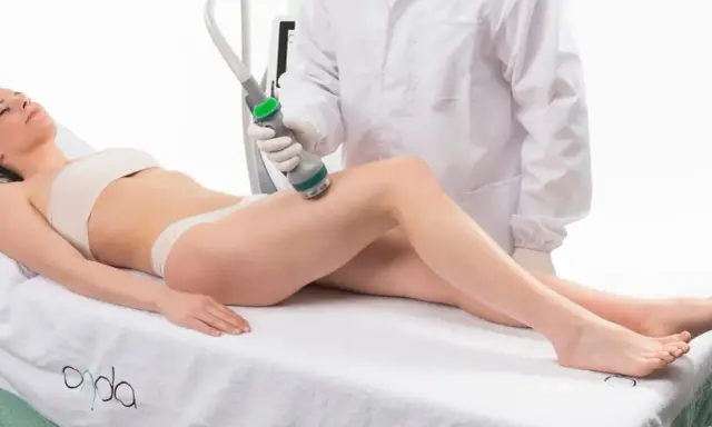 Trattamento estetico con tecnologia onda coolwaves per rimodellare il corpo.