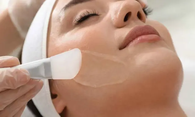 Applicazione di un peeling per acne sul viso di una donna, con un pennello in silicone.