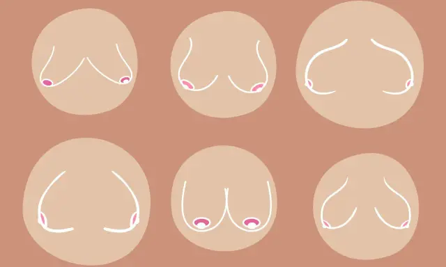 Illustrazione di sei seni cadenti, con diverse forme e posizioni, rappresentati con linee bianche su sfondo color carne.