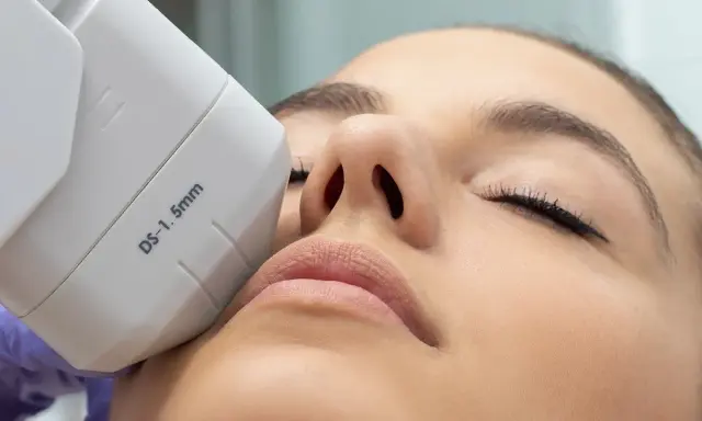 Trattamento viso con laser per macchie: scopri le opinioni e i risultati di questa procedura estetica per una pelle uniforme e luminosa.