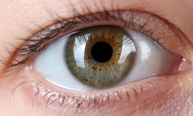 Occhio con iride verde-marrone, ciglia scure e pelle chiara. Un'immagine che evoca la ricerca di un filler per palpebre cadenti per uno sguardo più giovane.