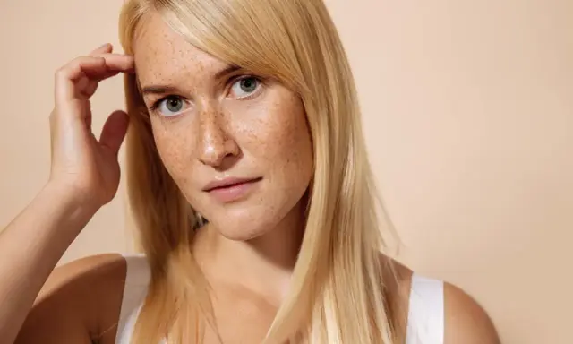 Giovane donna con lentiggini, capelli biondi e sguardo intenso. Immagina un trattamento di pico laser viso per una pelle radiosa.