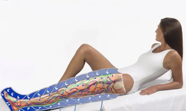 Illustrazione che mostra come funziona la pressoterapia: un manicotto avvolge la gamba, simulando il massaggio linfatico e la circolazione sanguigna.