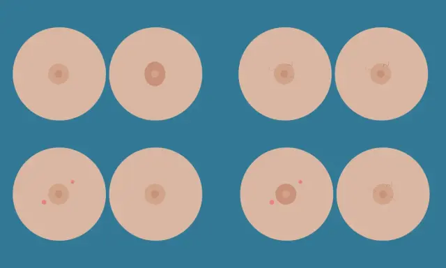Illustrazione di seni con diverse forme di capezzoli, inclusi quelli piatti, a dimostrazione che un capezzolo piatto è normale.